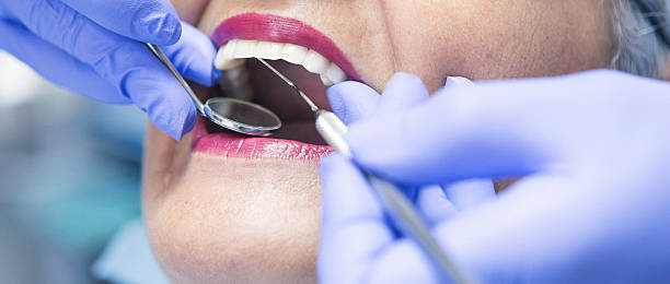 Best Emergency Dentist for Lost Fillings or Crowns in Chaffee, MO